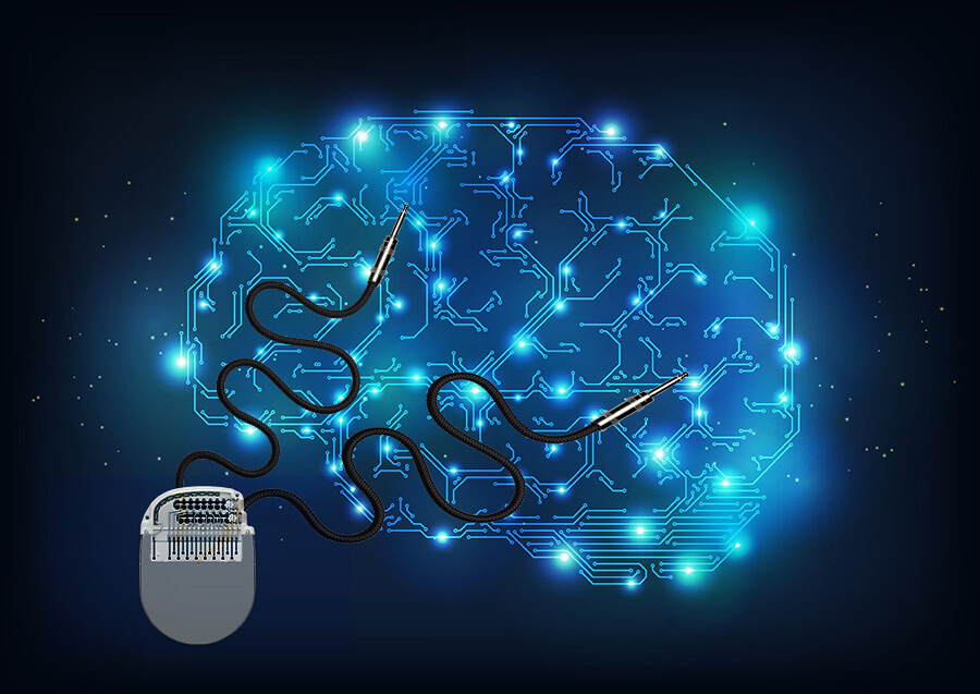 Beyin pili Dalgaları